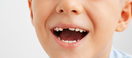 The child laughs, showing the gap from the missing tooth.の写真素材