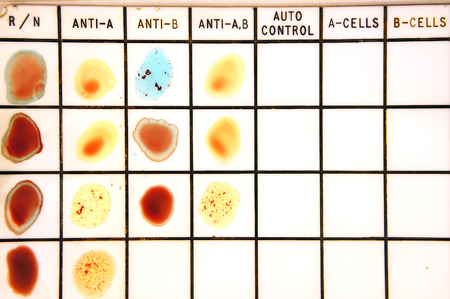Blood type testの写真素材