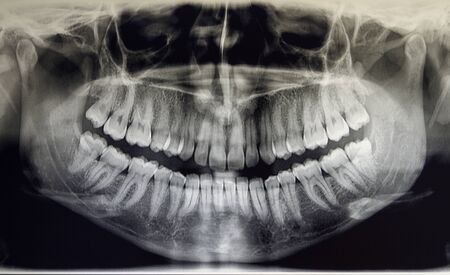 Orthopantomography of an adult patient, dentistryの写真素材