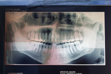 Orthopantomography of an adult patient, dentistryの写真素材