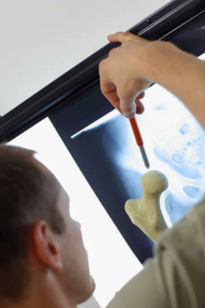 Specialist with femur bone model  watching image of pelvis  at x-ray film viewer,....