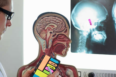 Specialist  working with human model watching images of skull  at x-ray film viewer. Diagnosis,treatment planningの写真素材