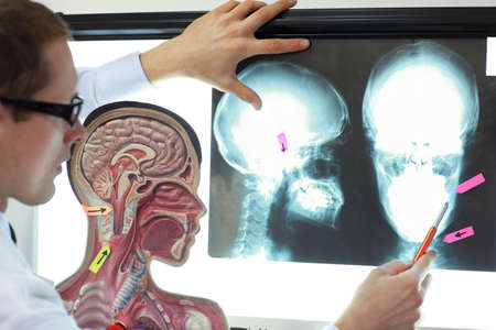 Specialist  with human model watching images of skull  at x-ray film viewer. Diagnosis,treatment...