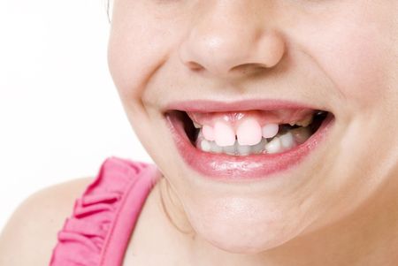 small girl toothless smile  close up