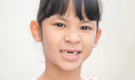 lost milk teeth - lost baby tooth , smile face of a child girl baby teeth of tooth loss , her milk tooth fell out and her growing permanent tooth in open mouth dental health problems conceptの写真素材