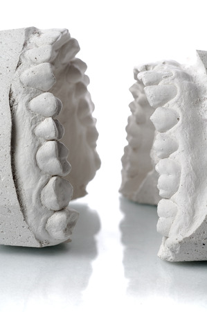 Gypsum jawsの写真素材