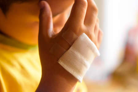 Wound on hand of child.Close up and concept for healthの写真素材