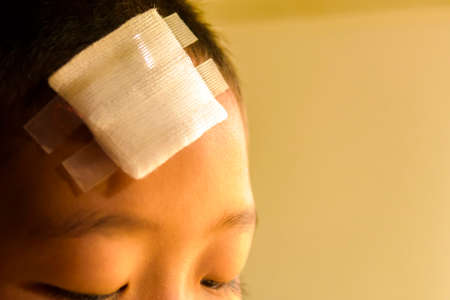 Wound on head of child.Close up and concept for health
