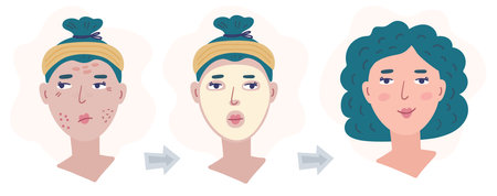 Illustration diagram of the application of a mask or cosmetic product for the face. Pretty girl is doing the procedure.のイラスト素材
