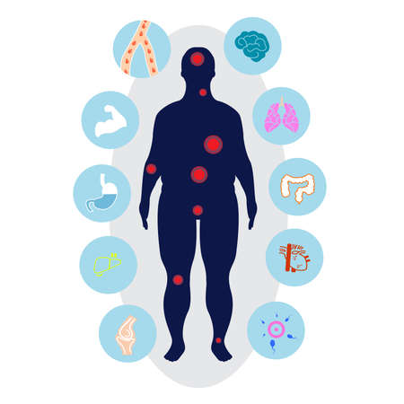 Obesity related diseases and preventionのイラスト素材