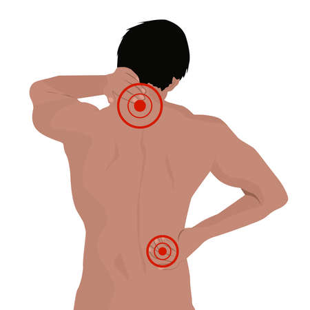 Muscular man with back neck ache .のイラスト素材