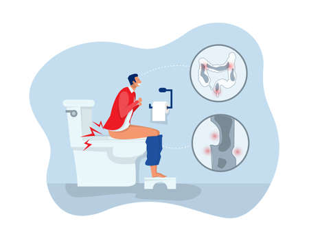 man sitting on the toilet and suffering from hemorrhoids. Problem with health, feeling bad flat vector illustrationのイラスト素材