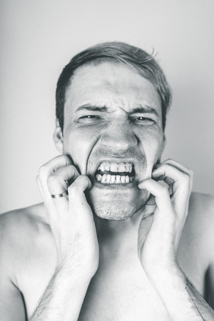 emotional portrait of a crazy guy in closeup. concept: the nervous breakdown, mental disease, headaches and migraine. black and white treatmentの写真素材
