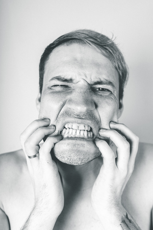 emotional portrait of a crazy guy in closeup. concept: the nervous breakdown, mental disease, headaches and migraine. black and white treatmentの写真素材