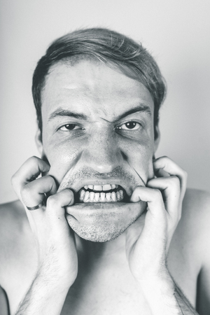 emotional portrait of a crazy guy in closeup. concept: the nervous breakdown, mental disease, headaches and migraine. black and white treatmentの写真素材