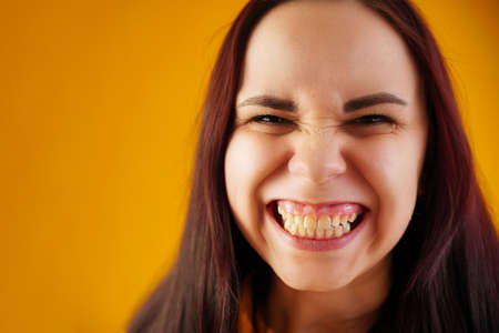 Portrait of young woman with grimacing face. Close up of funny female showing overbite on yellow backgroundの写真素材