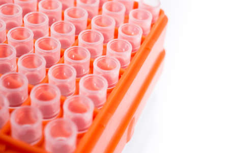 science background pipette tipsの写真素材