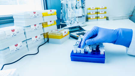 Rostock, Germany - april 17, 2017: Lab Assistant makes a clinical or medical analysis of sample in one test tubeのeditorial素材