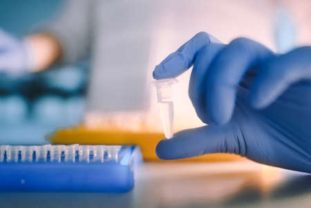 Laboratory tests for viral infections. Coronavirus nCoV, MERS-Cov respiratory syndrome coronavirus....