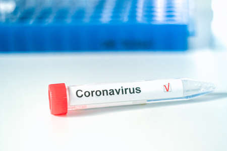 Coronavirus test. Hand in gloves holds a test tube with a corona virus test label on blurred...