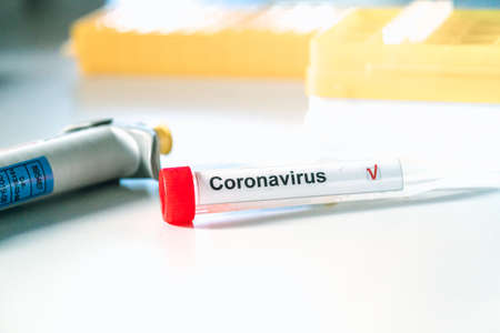 Coronavirus test. Hand in gloves holds a test tube with a corona virus test label on blurred laboratory in the background. COVID-19 or SARS-CoV-2 test concept.の写真素材