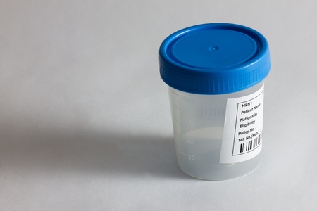 Specimen bottle isolated on whiteの写真素材