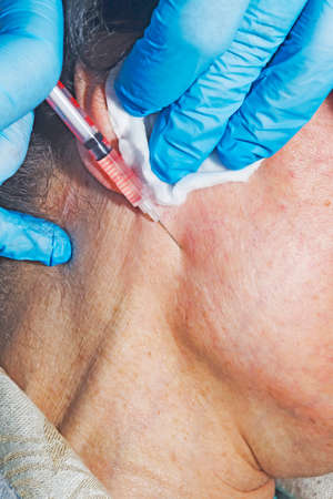 Dermatologist cosmetologist applies cosmetic injection of botox on a middle-aged patient at beauty clinicの写真素材