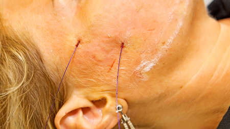 Filaments of polylactic acid applied in the face before extending - Selective focus