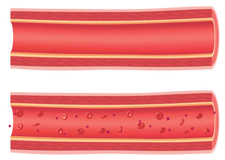 Anatomical vesselsのイラスト素材