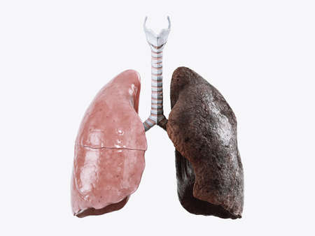 Realistic 3d illustration of healthy human lungs vs smoker lungs isolated on white background. Front...