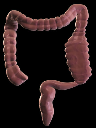 obstipation