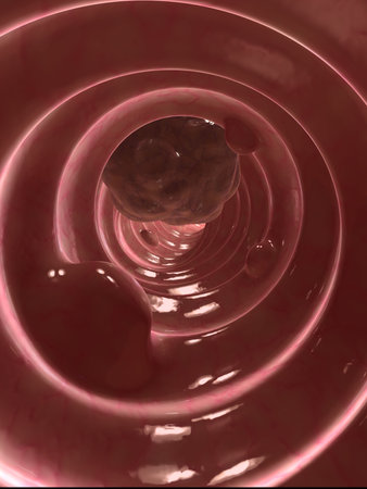 colon tumor