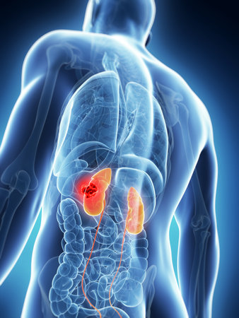 3d rendered illustration of the male kidneys - cancer