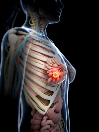 3d rendered illustration of breast cancerの写真素材