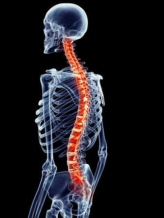 medically accurate illustration - painful spine