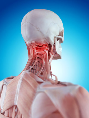 medically accurate illustration of a painful atlasの写真素材