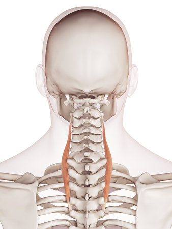 medically accurate muscle illustration of the longissimus cervicisの写真素材