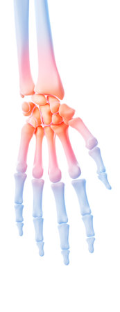 medical 3d illustration of a painful wristの写真素材