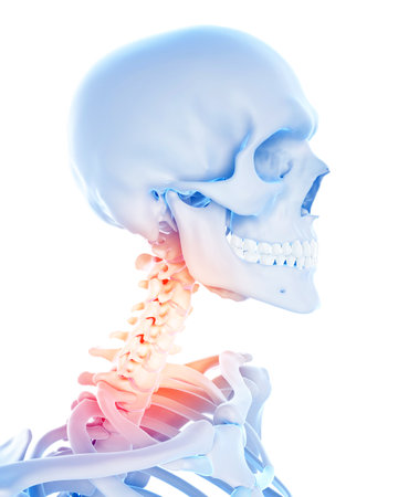 medical 3d illustration of a painful cervical spineの写真素材