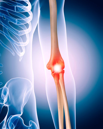 medically accurate 3d illustration of painful ellbowの写真素材