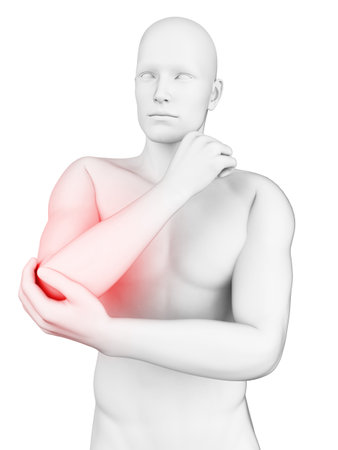 3d rendered illustration of a painful elbowの写真素材
