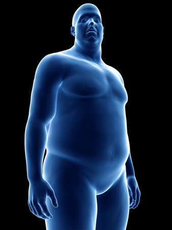3d rendered medically accurate illustration of an obese manの写真素材