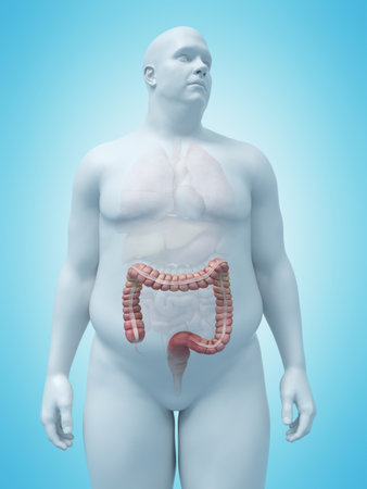 3d rendered medically accurate illustration of an overweight mans colonの写真素材