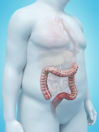 3d rendered medically accurate illustration of an overweight mans colonの写真素材