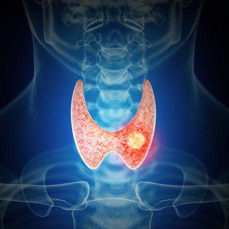 3d rendered medically accurate illustration of thyroid cancerの写真素材
