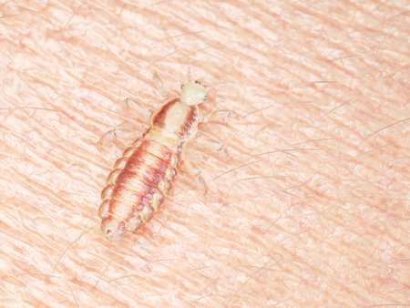 3d rendered medically accurate illustration of a head louse on human skinの写真素材