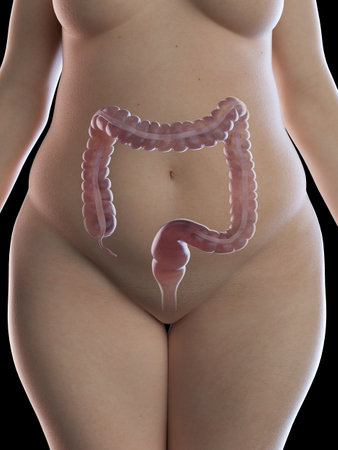 3d rendered medically accurate illustration of an obese womens colonの写真素材
