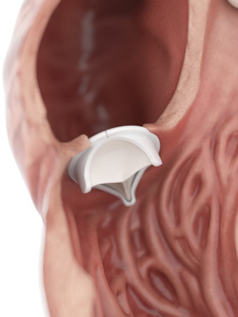 3d rendered medically accurate illustration of an artificial heart valve