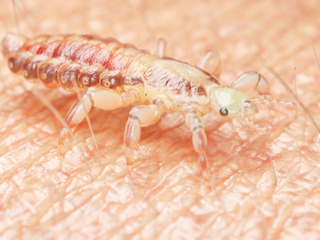 3d rendered medically accurate illustration of a head louse on human skinの写真素材