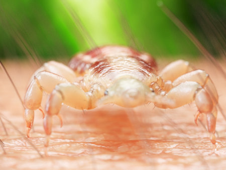3d rendered medically accurate illustration of a head louse on human skin